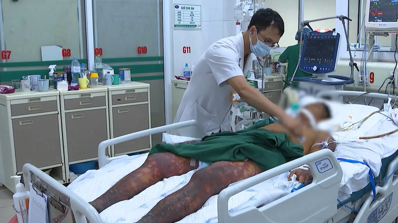 Liên cầu lợn: Đừng để hối hận khi đã muộn | Sức khỏe cộng đồng | 26/07/2025